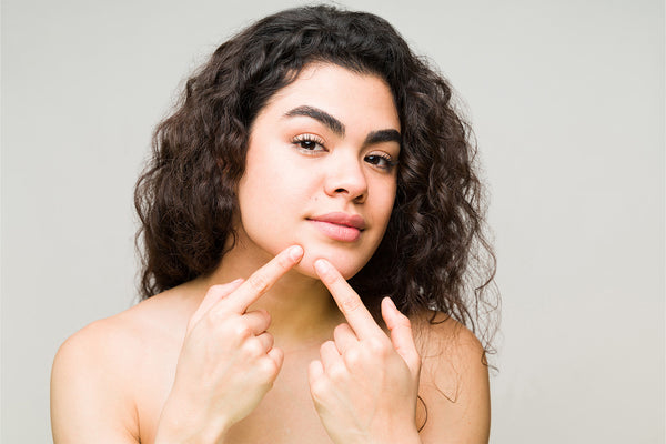 What Causes Chin Acne & What Role Do Hormones Play?